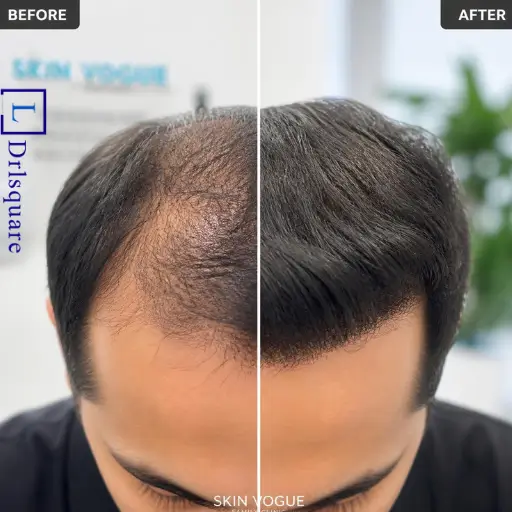 Homeopathic hair loss treatment at Dr. L Square Multispecialty Homeopathy Clinic in Kolaghat, West Bengal.