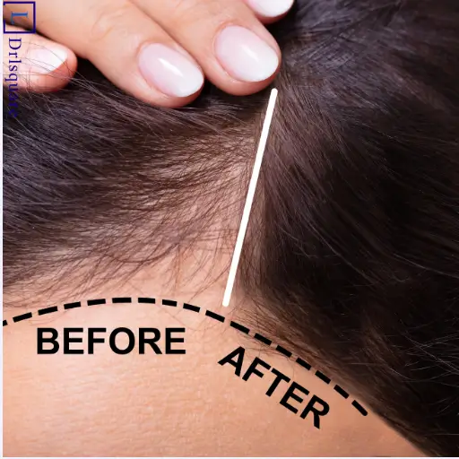 Hair treatment results at Dr. L Square Multispecialty Homeopathy Clinic in Kolaghat.