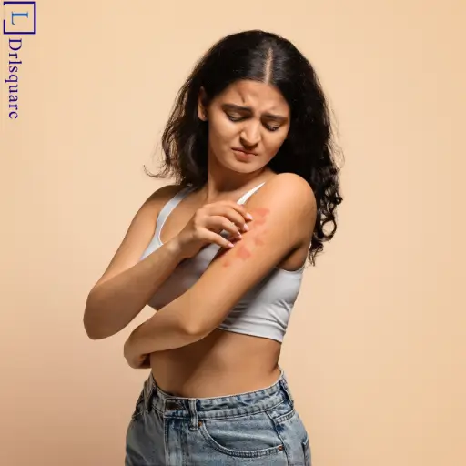 Common causes of psoriasis explained by Dr. L Square Multispecialty Homeopathy Clinic in Kolaghat.