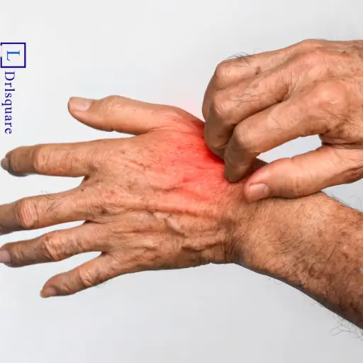 Homeopathic treatment for skin eczema at Dr. L Square Multispecialty Homeopathy Clinic in Kolaghat.