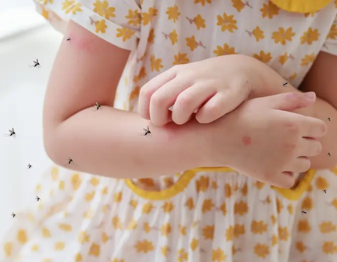 Natural homeopathic treatment for severe insect bite and sting allergic reactions at Dr. L Square Multispecialty Homeopathy Clinic