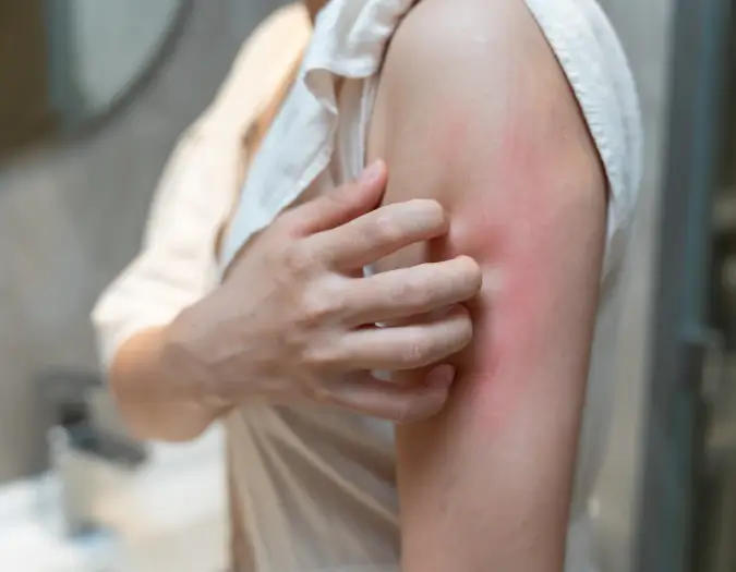 Person scratching itchy skin caused by allergic reaction receiving care at Dr. L Square Multispecialty Homeopathy Clinic