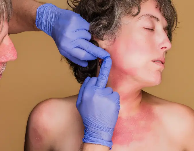 Red allergic skin rash and patch on sensitive skin examined by doctors at Dr. L Square Multispecialty Homeopathy Clinic